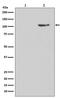 Glutamate Ionotropic Receptor AMPA Type Subunit 1 antibody, P02677, Boster Biological Technology, Western Blot image 