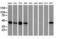 Vasodilator Stimulated Phosphoprotein antibody, LS-C785698, Lifespan Biosciences, Western Blot image 