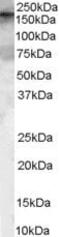 Rho Guanine Nucleotide Exchange Factor 5 antibody, PA5-18471, Invitrogen Antibodies, Western Blot image 