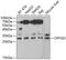 Crystallin Gamma D antibody, GTX53965, GeneTex, Western Blot image 