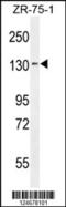 Tolloid Like 1 antibody, 55-393, ProSci, Western Blot image 