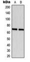 Estrogen Receptor 1 antibody, orb216104, Biorbyt, Western Blot image 