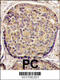 Phosphatidylinositol-4,5-Bisphosphate 3-Kinase Catalytic Subunit Beta antibody, 63-344, ProSci, Immunohistochemistry paraffin image 