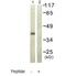 Heterogeneous Nuclear Ribonucleoprotein D antibody, ab61193, Abcam, Western Blot image 