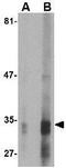 Endonuclease G antibody, GTX84988, GeneTex, Western Blot image 