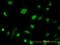 Adenylate Kinase 1 antibody, H00000203-M06, Novus Biologicals, Immunocytochemistry image 