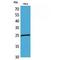 Peroxiredoxin 1 antibody, LS-C387211, Lifespan Biosciences, Western Blot image 