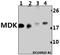 Midkine antibody, A01823, Boster Biological Technology, Western Blot image 
