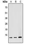 ATP Synthase Membrane Subunit C Locus 2 antibody, MBS8212647, MyBioSource, Western Blot image 