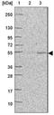 Eukaryotic Translation Initiation Factor 2B Subunit Gamma antibody, NBP1-83987, Novus Biologicals, Western Blot image 