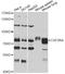 Colony Stimulating Factor 2 Receptor Alpha Subunit antibody, STJ23237, St John