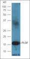 Placental Growth Factor antibody, orb312436, Biorbyt, Western Blot image 