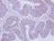 Phosphorylase Kinase Regulatory Subunit Alpha 2 antibody, GTX108342, GeneTex, Immunohistochemistry paraffin image 