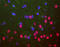 TAR DNA Binding Protein antibody, LS-B12387, Lifespan Biosciences, Immunofluorescence image 