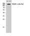 Platelet Derived Growth Factor Receptor Alpha antibody, STJ95000, St John