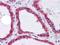 Heat Shock Protein Family A (Hsp70) Member 5 antibody, GTX83287, GeneTex, Immunohistochemistry paraffin image 