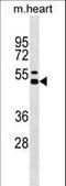 Interleukin 12B antibody, LS-C158217, Lifespan Biosciences, Western Blot image 