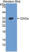 VICKZ family member 2 antibody, LS-C294643, Lifespan Biosciences, Western Blot image 