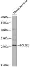 BCL2L2-PABPN1 Readthrough antibody, 15-008, ProSci, Western Blot image 