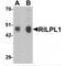 Rab Interacting Lysosomal Protein Like 1 antibody, MBS150318, MyBioSource, Western Blot image 