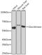 Glucokinase antibody, GTX03171, GeneTex, Western Blot image 