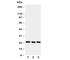 Peroxiredoxin 1 antibody, R30865, NSJ Bioreagents, Western Blot image 