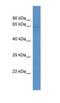 Solute Carrier Family 22 Member 3 antibody, NBP1-80529, Novus Biologicals, Western Blot image 