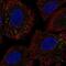 Coiled-Coil Domain Containing 65 antibody, NBP2-56860, Novus Biologicals, Immunofluorescence image 