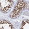 Tropomodulin 2 antibody, NBP1-87378, Novus Biologicals, Immunohistochemistry frozen image 