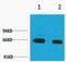 Albumin antibody, STJ97128, St John