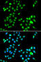 Twist Family BHLH Transcription Factor 1 antibody, STJ29453, St John