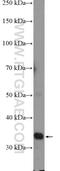 Protein Phosphatase 1 Regulatory Subunit 3B antibody, 14190-1-AP, Proteintech Group, Western Blot image 