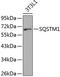 Sequestosome 1 antibody, A11247, ABclonal Technology, Western Blot image 