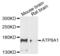 ATPase Phospholipid Transporting 8A1 antibody, LS-C335333, Lifespan Biosciences, Western Blot image 