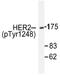 ERBB2 antibody, AP20949PU-N, Origene, Western Blot image 