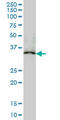 Microtubule Associated Protein RP/EB Family Member 2 antibody, LS-C105108, Lifespan Biosciences, Western Blot image 