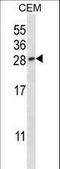 Placental Growth Factor antibody, LS-B15663, Lifespan Biosciences, Western Blot image 