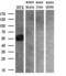 Solute Carrier Family 2 Member 6 antibody, M11862, Boster Biological Technology, Western Blot image 