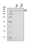 ATR Serine/Threonine Kinase antibody, A00262-3, Boster Biological Technology, Western Blot image 