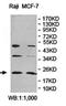 ADP Ribosylation Factor 3 antibody, orb78355, Biorbyt, Western Blot image 