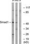 SMAD Family Member 1 antibody, TA312831, Origene, Western Blot image 