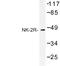 Substance-K receptor antibody, LS-C177106, Lifespan Biosciences, Western Blot image 