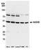 Hydroxyacyl-CoA Dehydrogenase Trifunctional Multienzyme Complex Subunit Beta antibody, A305-020A, Bethyl Labs, Western Blot image 