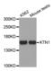 Kinectin 1 antibody, abx004510, Abbexa, Western Blot image 