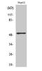 Activating Transcription Factor 2 antibody, STJ91750, St John