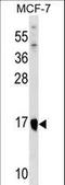 Integrin cytoplasmic domain-associated protein 1 antibody, LS-C159938, Lifespan Biosciences, Western Blot image 