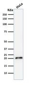 p21 antibody, GTX02619, GeneTex, Western Blot image 