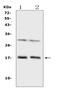 Interleukin 1 Family Member 10 antibody, A09268-1, Boster Biological Technology, Western Blot image 