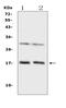 IL-1 theta antibody, A09268-1, Boster Biological Technology, Western Blot image 