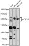 Colony Stimulating Factor 1 Receptor antibody, GTX33122, GeneTex, Western Blot image 